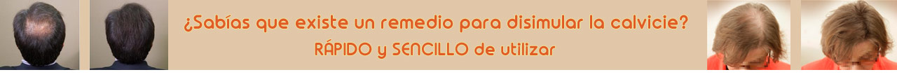 Remedio para disimular la calvicie